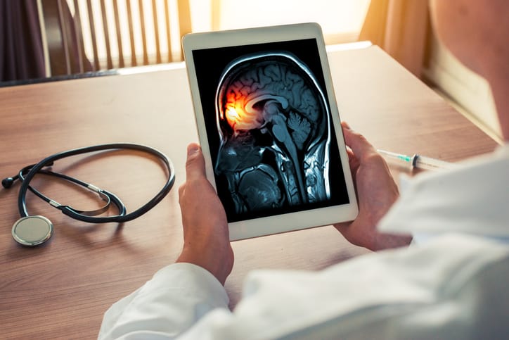 Doctor holding a digital tablet with x-ray of brain and skull skeleton. Headache, meningitis and migraine concept